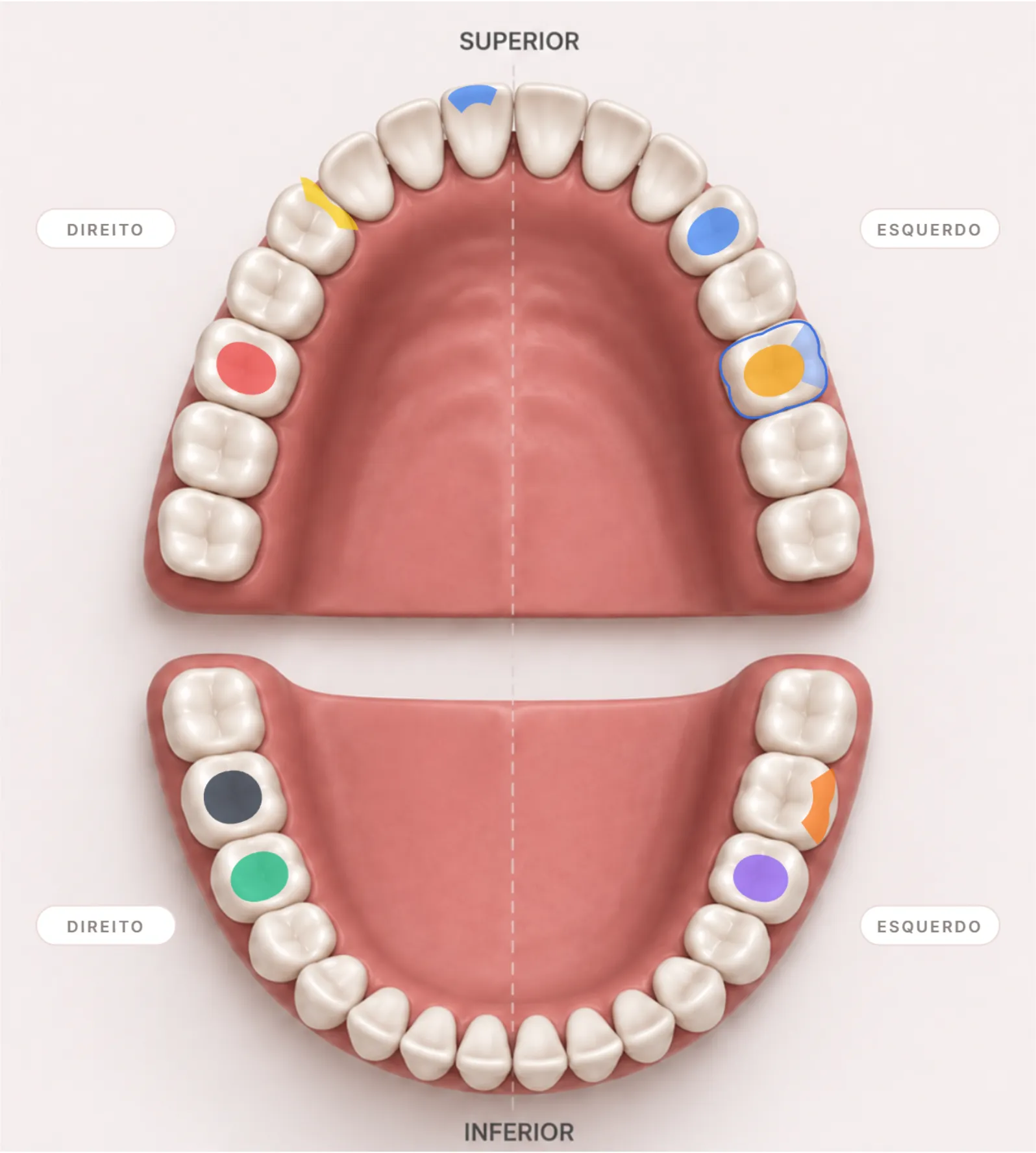 Arcada 3D do odontograma com dentes marcados por status em cores