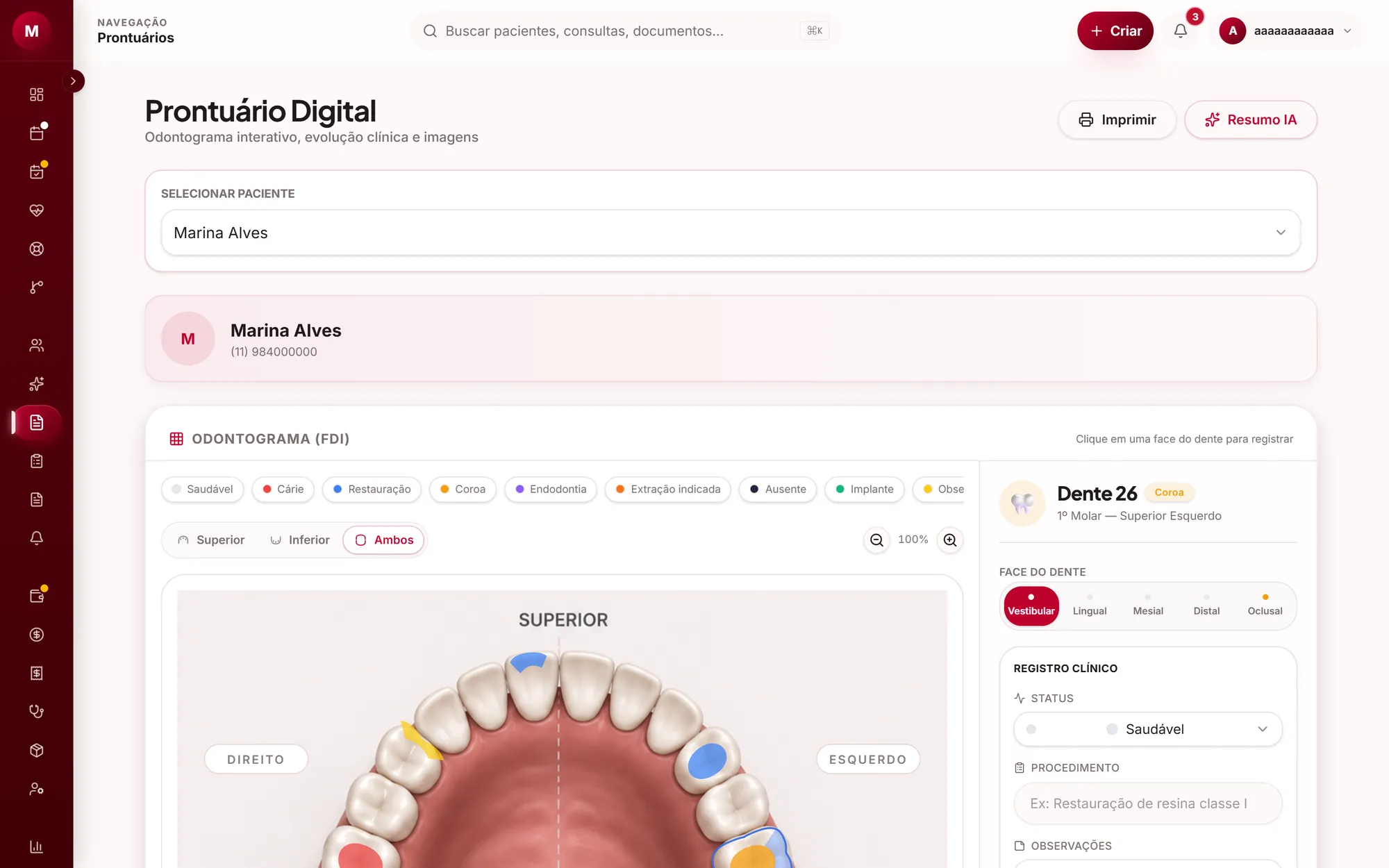 Odontograma 3D do NexOdontoSys com um dente selecionado e o painel clínico aberto